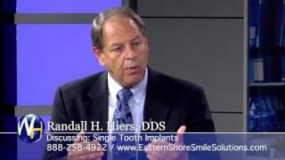 Single-Tooth Implants with Cambridge MD dentist Randall H. Hiers, DDS
