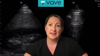 POCUS in Primary Care  |  April EduCast  |  Vave Health