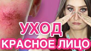 КУПЕРОЗ и РОЗАЦЕА 🟥 Уход при красноте кожи 