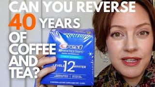 Crest Whitening Strips Review | Before and After (Sensitivity? Effective?)