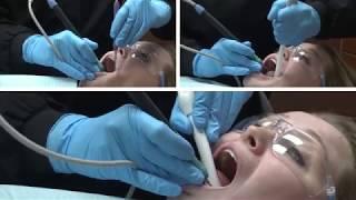Purevac® HVE System - Evacuation Device Comparison | Dentsply Sirona