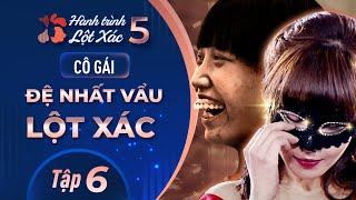 Hành Trình Lột Xác mùa 5 | Tập 6: Vũ Thị Hợp - Cô gái "đệ nhất Vẩu" lột xác