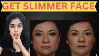 Get slimmer face with Botox : Dr. Anvika /8287001211