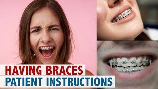 Having Braces Patient Instructions