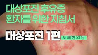 (대상포진 1편) 대상포진 후유증 환자를 위한 지침서 / 개요,증상,특징 핵심총정리