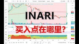 07 11 2024 第568期：INARI 买入点在哪里？