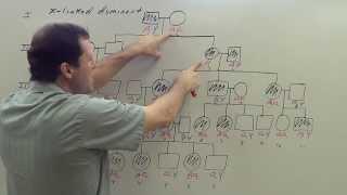 X Linked Dominant Pedigree