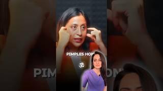 Acne face mapping | can acne show problems in internal organs | dermatologist comments