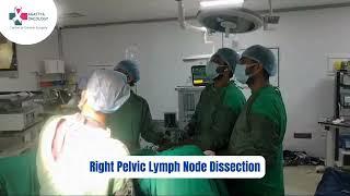 Uterine Cancer - Live Surgery-  By Best Surgeons At Agastya Oncology, Surat, Gujarat