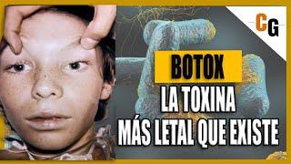 Toxina Botulínica - Botox LA TOXINA mas PODEROSA del Mundo - Fisiopatología y Síntomas del Botulismo