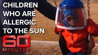 Children of the Night: Young kids allergic to the sun | 60 Minutes Australia