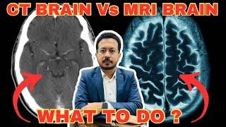 CT Brain Vs MRI Brain  Kaunsa brain scanning better hai ?