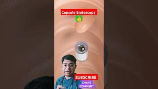 What is Capsule Endoscopy? #healthsciences #endoscopy #science