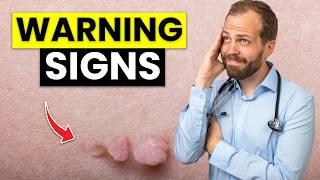 Skin Tags: What Do They REALLY Mean? (Don't miss this warning sign)