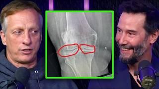 Tony Hawk Tells Keanu About His Stem Cell Surgery