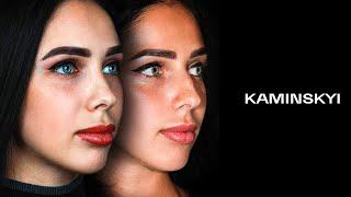 Closed rhinoplasty with dorsum preservation / KAMINSKYI