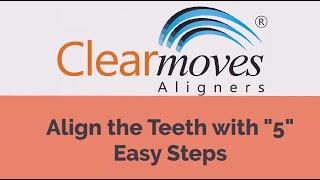 5 easy steps to Align your teeth || Clear Moves Aligners