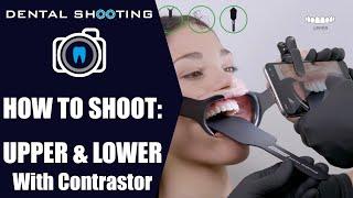 HOW TO SHOOT: UPPER  & LOWER WITH CONTRASTOR (Dental Shooting)