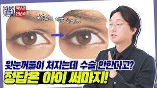 처진 눈꺼풀! 수술없이 해결이 가능하다고?! 노화로 발생한 안검하수 정답은 아이써마지!