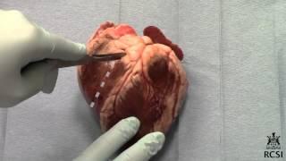 Sheep's Heart Dissection