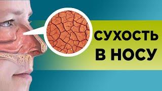 СУХОСТЬ В НОСУ