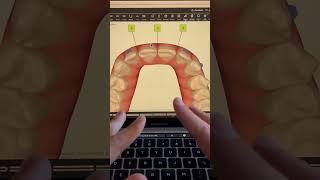 TIP 182 - PRE-PROSTHETIC ORTHODONTICS