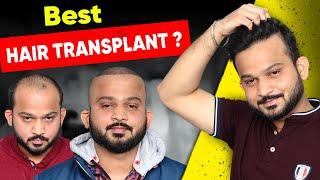 Hair Transplant in Ahmedabad | Best Results & Cost of Hair Transplant in Ahmedabad