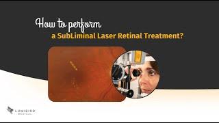 How to perform a SubLiminal Laser Retinal Treatment?