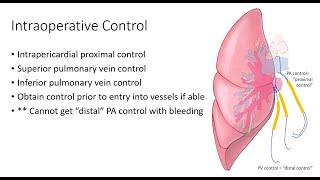 PA Control During Lung Surgery