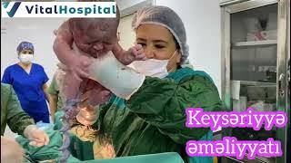 Keysəriyyə əməliyyatı. Vital Hospital 050-312-23-12