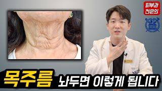 목주름 수술 없이 없애는 방법! 목주름 유형별 치료 방법 (보톡스, 필러, 레이저, 시술, 관리) 피부과전문의 닥터피부광