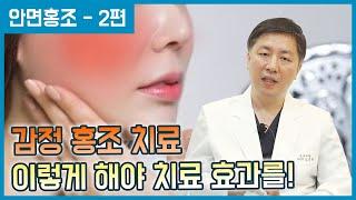 교감신경차단술을 통한 감정홍조 치료 이렇게 합니다! [안면 홍조 - 2편]