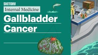 Gallbladder Cancer (Internal Medicine) | Sketchy Medical