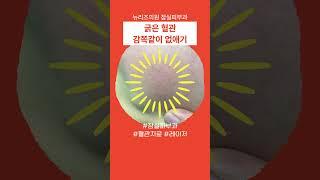 잠실피부과 여드름 흉터 치료  #뉴리즈의원잠실
