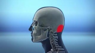 Poor posture due to smartphone use leads to 'horn bone' growth in skull