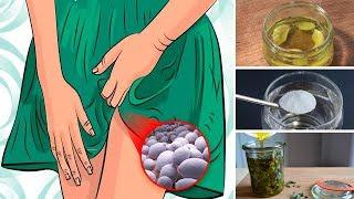 Top 8 Home Remedies for Yeast Infection (Candidiasis)