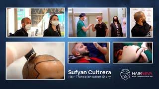 Sufyan Cultrera Hair Transplantation Story