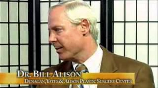 Dr Bill Alison - DYA Plastic Surgery of Huntsville - Rhinoplasty & Otoplasty