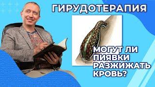 Гирудотерапия - лечение пиявками. Могут ли пиявки разжижать кровь?