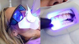 Is professional teeth whitening really worth it? Celebrity dentist spills all | Glam Lab