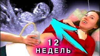 УВИДЕЛИ МАЛЫША - Мальчик ИЛИ Девочка ? Третье УЗИ 12 Недель 1 Скрининг - Я БЕРЕМЕННА | Elli Di