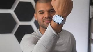 Xiaomi Redmi Watch 5 (review) l Beste Smartwatch UNTER 100€ ?