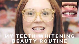 My Teeth Whitening Beauty Routine (WITH BEFORE AND AFTER PHOTOS) | Ginger Me Glam