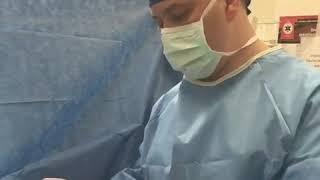 HiDef Liposuction with C-section scar revision