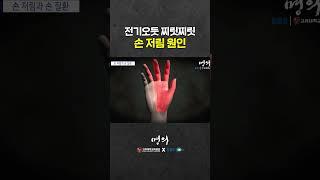 손이 저리는 3가지 원인