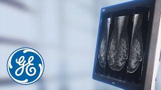 NEW Seno Iris ™ from GE Healthcare - Speed up your Mammography Diagnosis | GE Healthcare