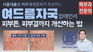 여드름자국 레이저