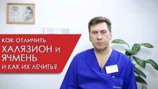 Как отличить халязион и ячмень и как эти заболевания лечить?