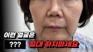 나에게 꼭 필요한 시술 수술만 받는법 | 상담실장들 말에 휘둘리지 않는 법 | 안티에이징 3단계 feat. 지방분해, 지방흡입, 리프팅, 필러, 지빙이식, 스컬트라