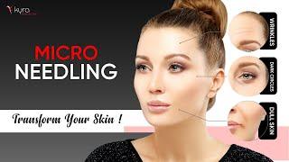 Does Micro needling Really Work? Kyra Clinic Ludhiana Punjab